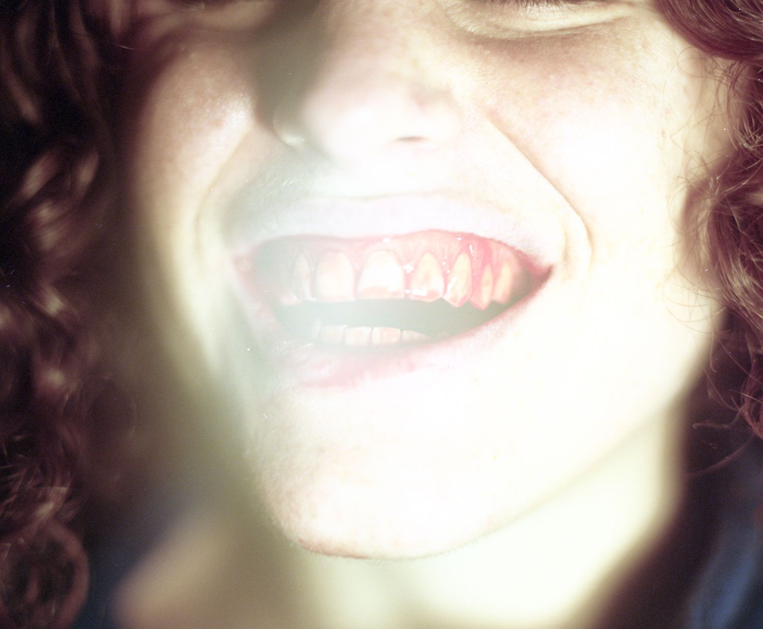 Overexposed close-up of a smile